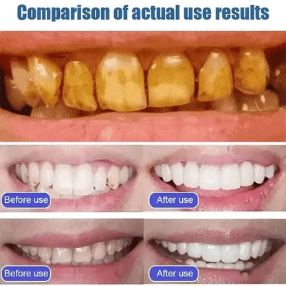 🦷 SP-6 Whitening Toothpaste | Probiotic Teeth Whitening for Stains, Bad Breath & Gum Health