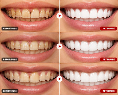 🦷 SP-6 Ultra+ Probiotic Whitening Toothpaste | Probiotic Teeth Whitening for Stains, Bad Breath & Gum Health