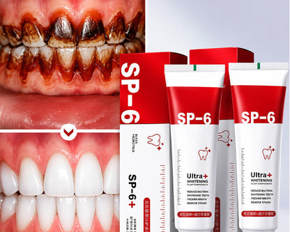 🦷 SP-6 Ultra+ Probiotic Whitening Toothpaste | Probiotic Teeth Whitening for Stains, Bad Breath & Gum Health