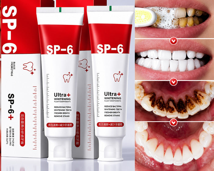 🦷 SP-6 Ultra+ Probiotic Whitening Toothpaste | Probiotic Teeth Whitening for Stains, Bad Breath & Gum Health